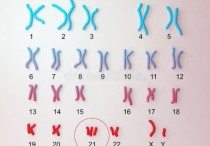 yq號染色體是什么意思 性染色體為xxy的男性正常嗎