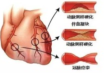 火邪開室什么意思 梔子葉泡水喝的功效